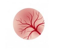 Inflamação da mucosa da bexiga e tratamento com cápsulas feminais